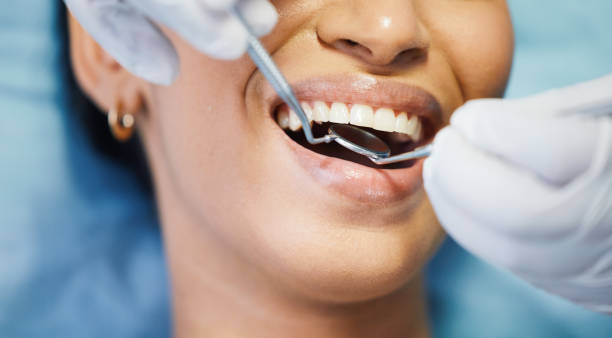 Best Pediatric Emergency Dentist in Lake Mawk, OH