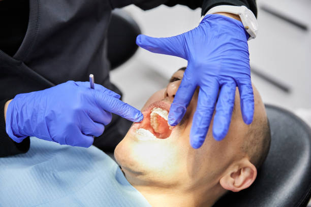 Best Emergency Wisdom Teeth Removal in Lake Mawk, OH