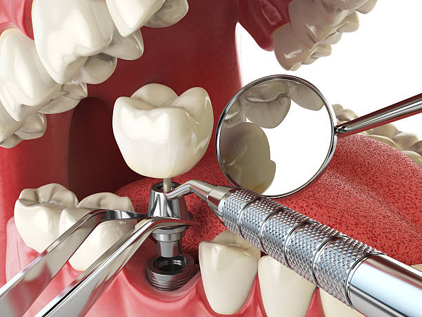 Best Emergency Gum Treatment in Lake Mawk, OH